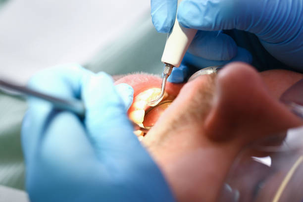 Best Cracked Tooth Emergency Dentist  in Oak Hill, FL