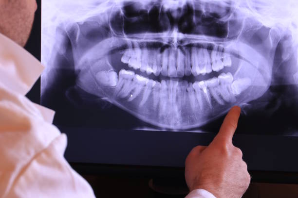 Best Emergency Dentist Near Me  in Oak Hill, FL