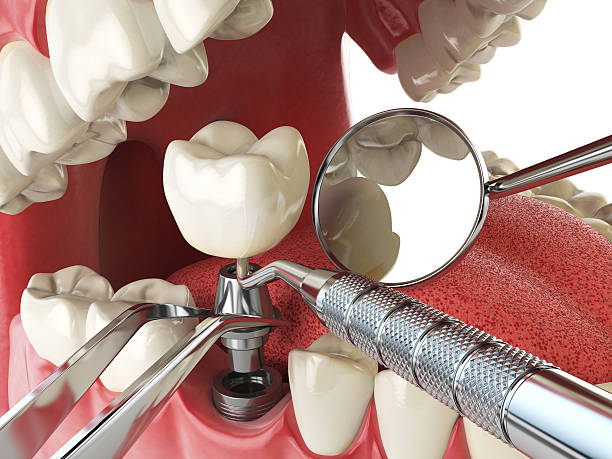 Best Emergency Gum Pain Relief  in Oak Hill, FL