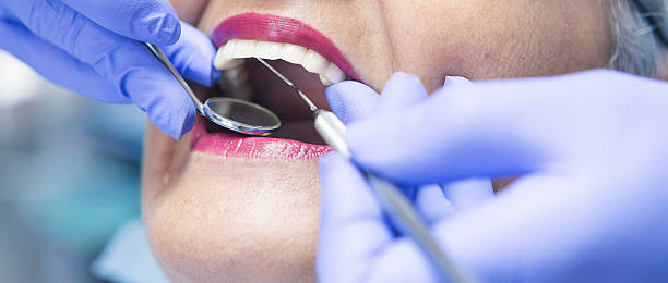 Best Broken Tooth Emergency  in Oak Hill, FL